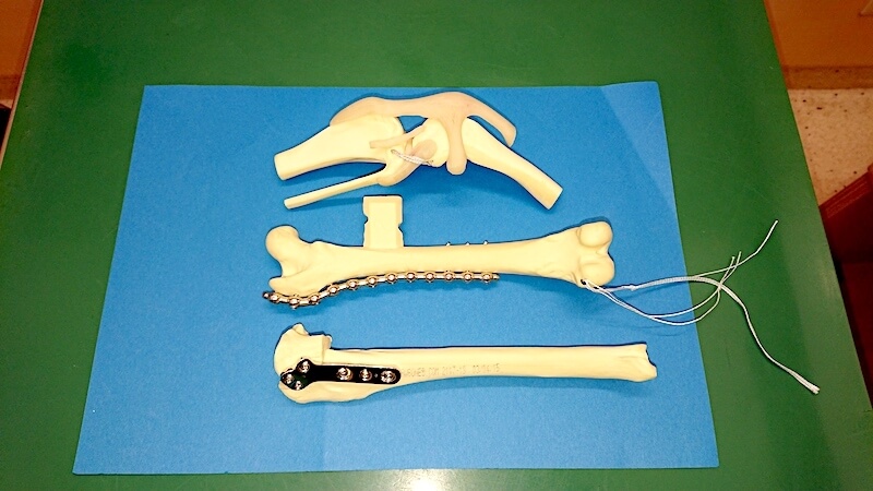 人工関節および人工靭帯に使う金具など 